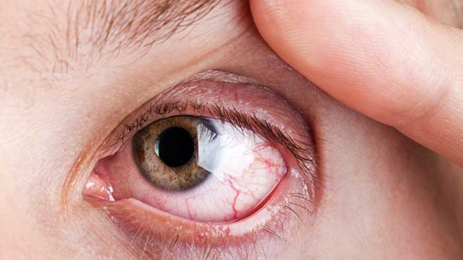 Eye health linked to dementia risk