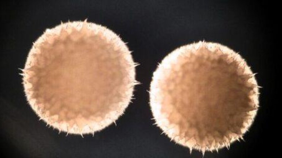 Qocalmanı yavaşladan dərman tapılıb - ARAŞDIRMA