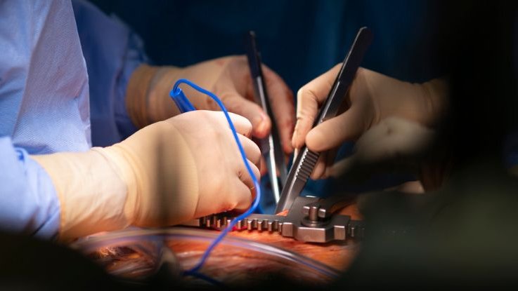 Ölü kalp yeniden çalıştırıldı