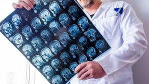 Harvard alimləri Alzheimer xəstəliyinin səbəbini tapıblar