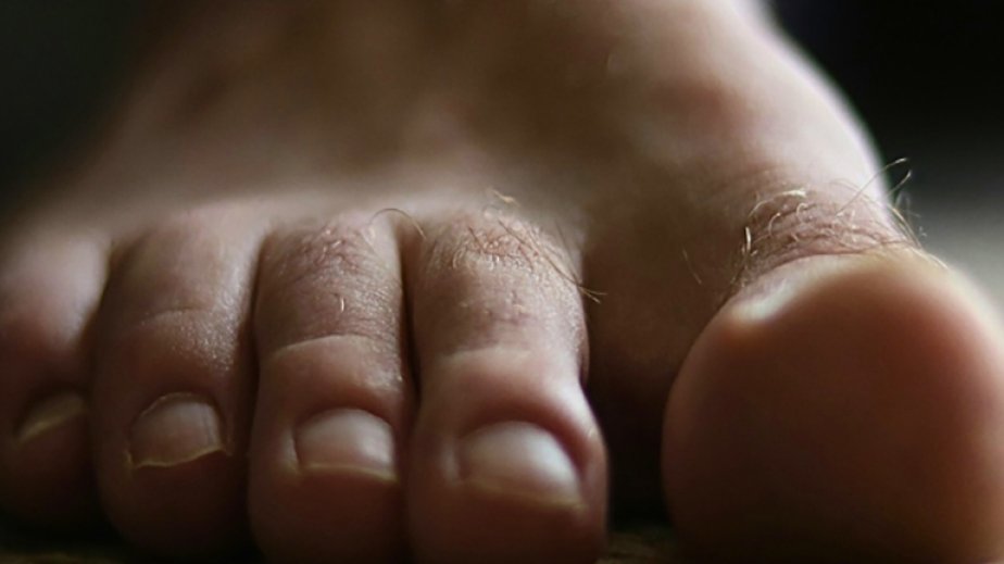 Ayaq barmaqları arasındakı nəmli mühit yüzlərlə növ mikrob üçün ideal yerdir - ARAŞDIRMA