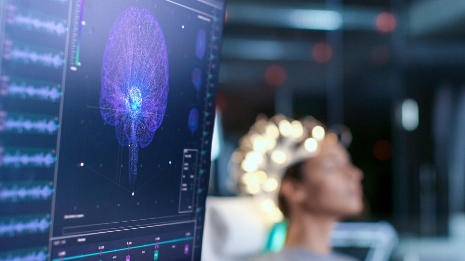 Britaniyada Alzheimer xəstəliyini üç dəqiqəyə aşkar edən üsul tapılıb