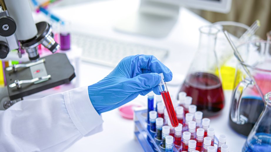 New clinical trial explores blood draws as alternative to bone marrow biopsy