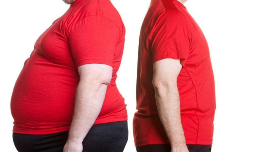 Genetic variants may explain why obesity affects people differently