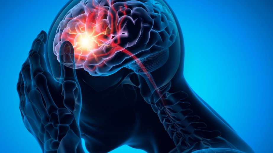 Stem cell therapy restores brain function after stroke