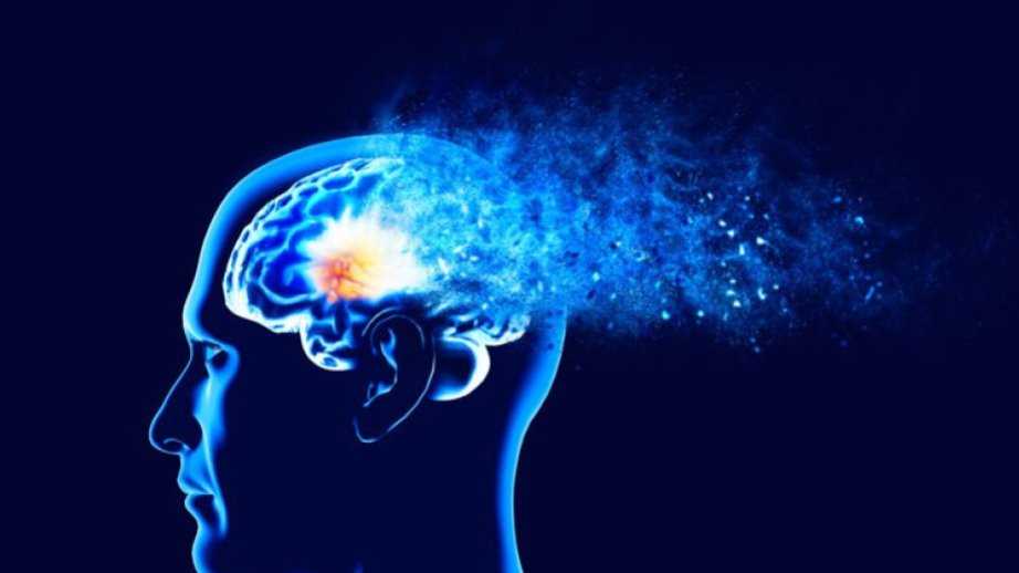 Brain shape changes could offer early warning signs of dementia