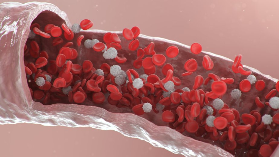 Study finds hidden blood mutations spark obesity, diabetes and liver disease