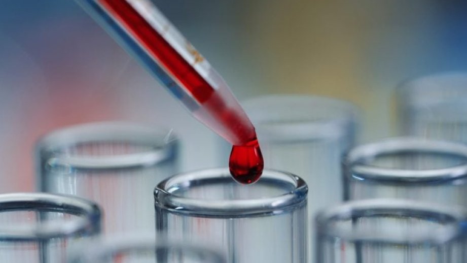 Alimlər xroniki yorğunluq sindromu üçün qan testi hazırlayıblar