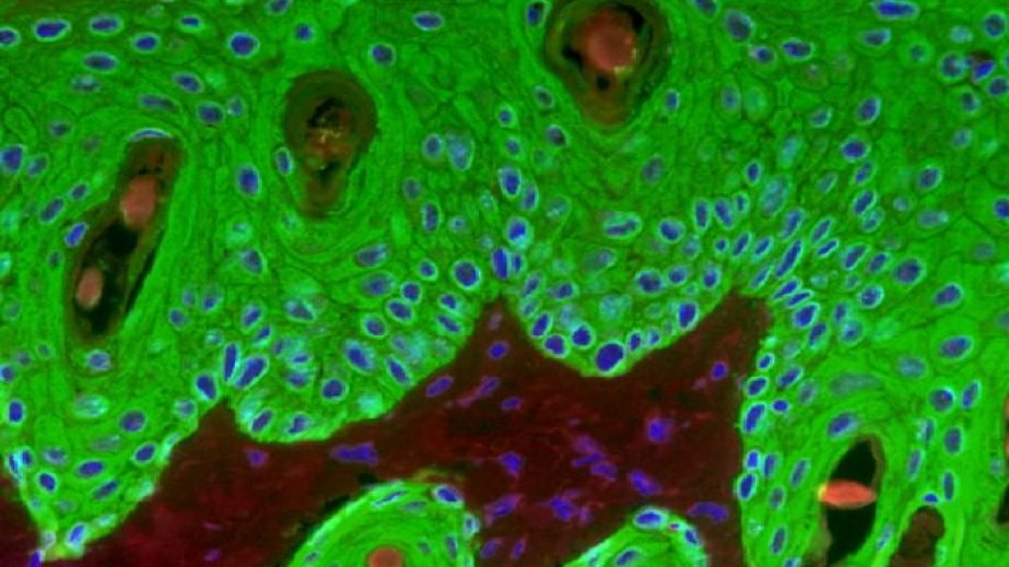 Japanese researchers develop implanted 'living skin' that glows to signal health changes