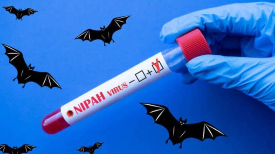 SA at 'no immediate risk' of Nepah virus - Health Department